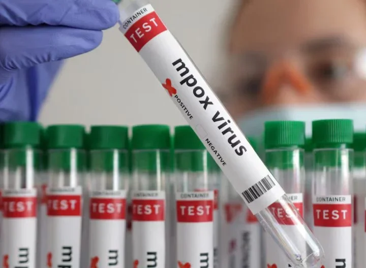 A test tube labelled Mpox. PHOTO/@WHOAFRO/X