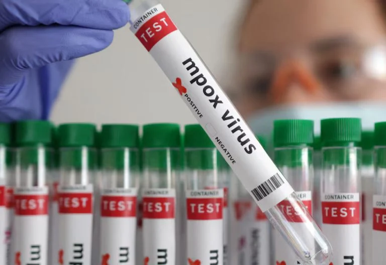 A test tube labelled Mpox. PHOTO/@WHOAFRO/X